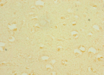 CSB-PA408252ESR2HU