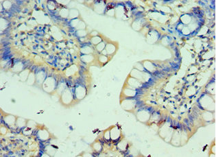 CSB-PA620968ESR1HU