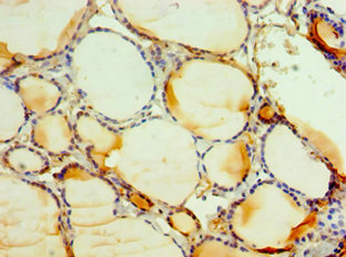 CSB-PA620968ESR1HU