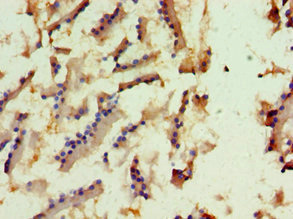 CSB-PA754540ESR1HU