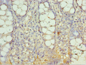 CSB-PA819153ESR1HU