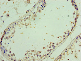 CSB-PA819153ESR1HU
