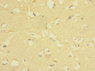 CSB-PA850317ESR1HU