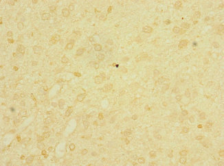 CSB-PA850317ESR1HU