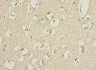 CSB-PA852884ESR2HU