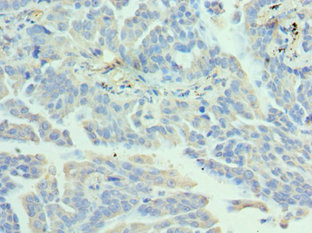 CSB-PA852913DSR2HU