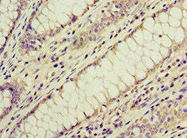 CSB-PA854112ESR1HU