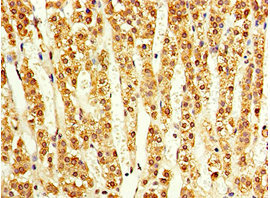 CSB-PA854112ESR1HU