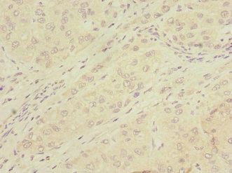 CSB-PA857450ESR1HU