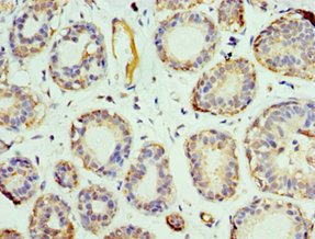 CSB-PA859937ESR2HU