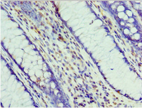 CSB-PA859937ESR2HU