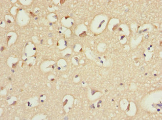 CSB-PA862061ESR2HU
