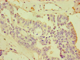 CSB-PA884474ESR2HU