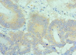 CSB-PA885770ESR1HU