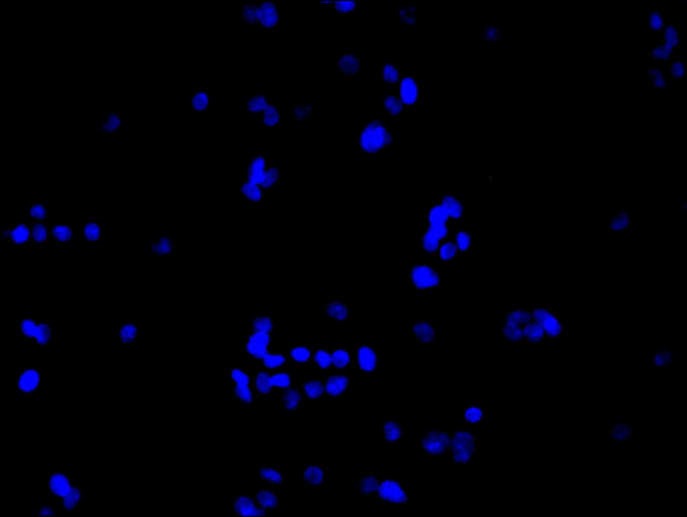CSB-PA887023ESR1HU