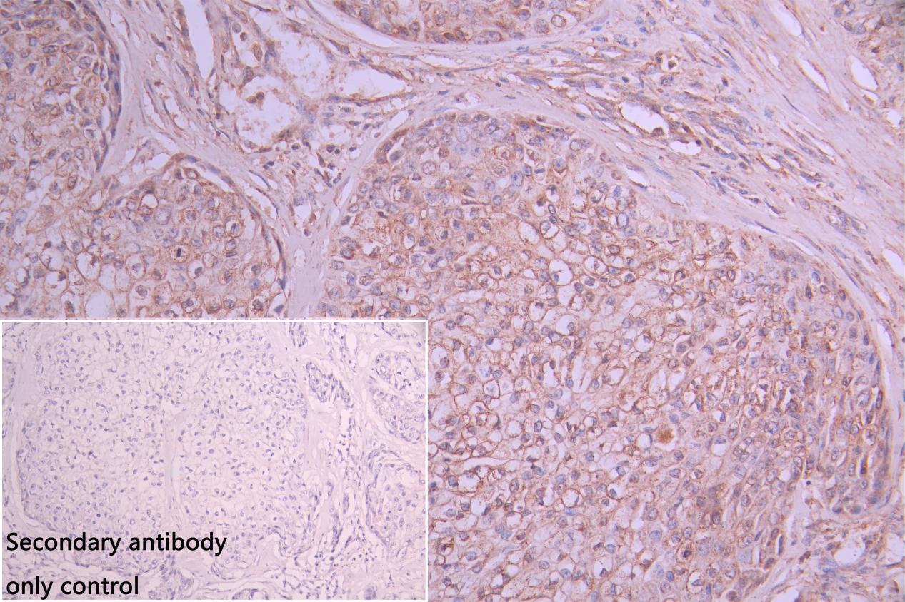 CSB-PA887023ESR1HU