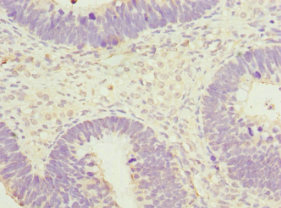 CSB-PA897305DSR1HU