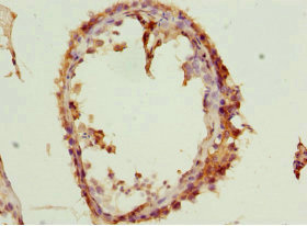 CSB-PA897305DSR1HU