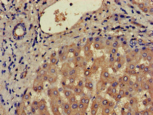 CSB-PA004842LA01HU