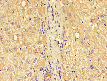 CSB-PA005490LA01HU