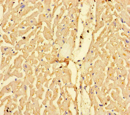 CSB-PA005922LA01HU