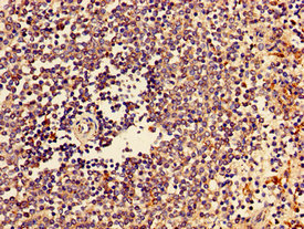CSB-PA006206LA01HU