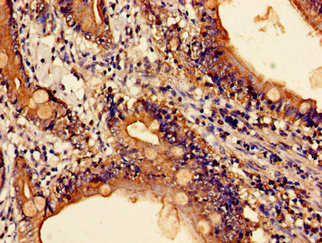 CSB-PA006206LA01HU