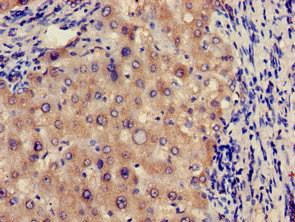 CSB-PA009062LA01HU