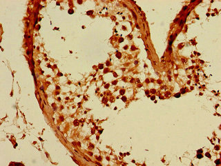 CSB-PA009381LA01HU