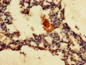 CSB-PA009813LA01HU