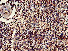 CSB-PA010084LA01HU