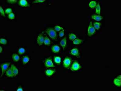 CSB-PA010469LA01HU