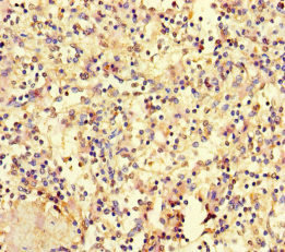 CSB-PA010689LA01HU