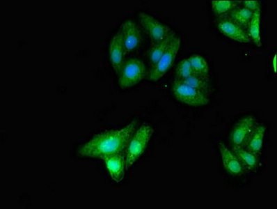 CSB-PA012306LA01HU
