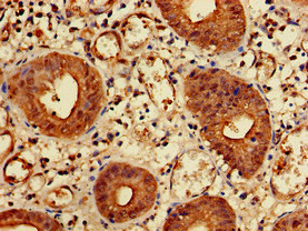 CSB-PA012306LA01HU