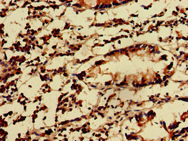 CSB-PA012306LA01HU
