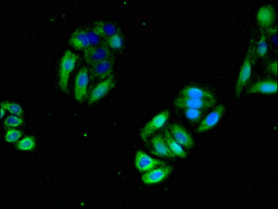 CSB-PA016070LA01HU