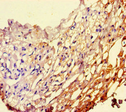 CSB-PA017766HA01HU