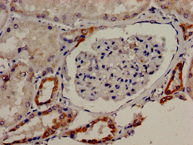 CSB-PA023218LA01HU