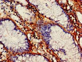 CSB-PA025834LA01HU