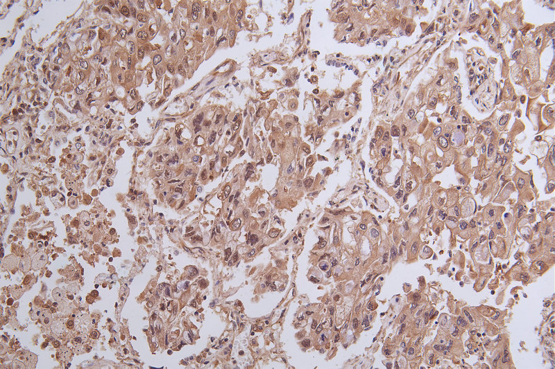CSB-PA026288LA01HU