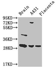 CSB-PA026288LA01HU