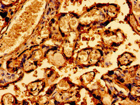 CSB-PA406800LA01HU