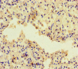 CSB-PA600142LA01HU