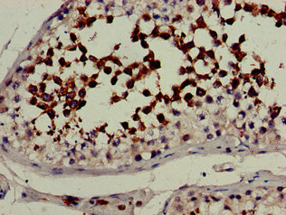 CSB-PA614993LA01HU