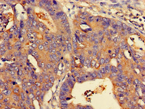 CSB-PA618768LA01HU