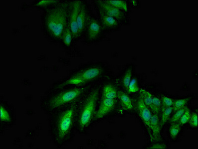CSB-PA622511LA01HU
