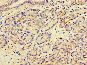 CSB-PA744028LA01HU