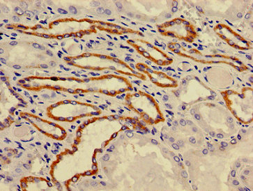 CSB-PA846292LA01HU