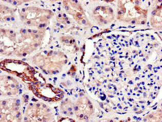 CSB-PA885703LA01HU
